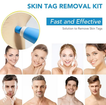 2-in-1 Painless Skin Tag, Mole, and Wart Removal Kit